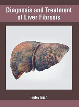 portada Diagnosis and Treatment of Liver Fibrosis (en Inglés)