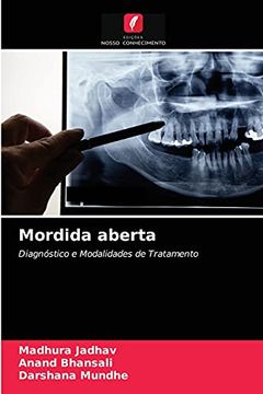 portada Mordida Aberta: Diagnóstico e Modalidades de Tratamento (in Portuguese)