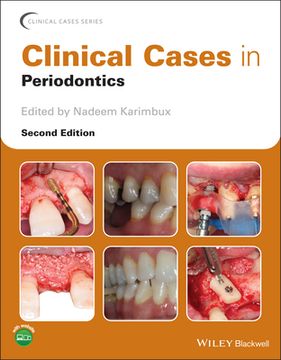 portada Clinical Cases in Periodontics (Clinical Cases (Dentistry)) (en Inglés)