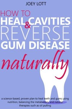 portada How to Heal Cavities and Reverse gum Disease Naturally: A Science-Based, Proven Plan to Heal Teeth and Gums Using Nutrition, Balancing the Metabolism, and Natural Therapies Such as oil Pulling (in English)