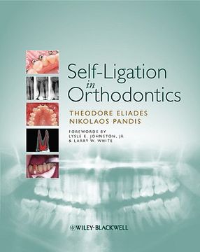 portada Self-Ligation in Orthodontics (en Inglés)