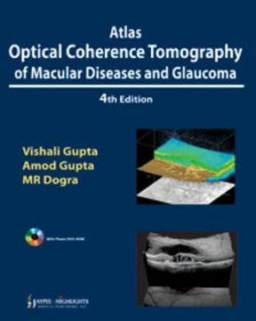 portada atlas optical coherence tomography of macular diseases and glaucoma