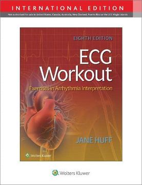 portada Ecg Workout: Exercises in Arrythmia Interpretation (en Inglés)