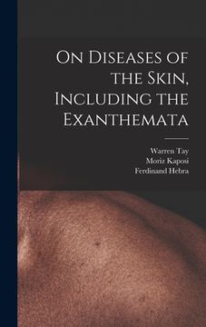 portada On Diseases of the Skin, Including the Exanthemata (en Inglés)