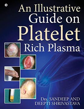 portada An Illustrative Guide on Platelet Rich Plasma (en Inglés)