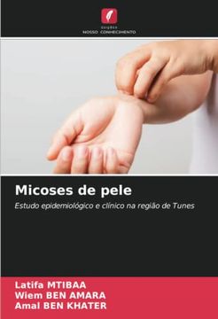 portada Micoses de Pele: Estudo Epidemiol�Gico e Cl�Nico na Regi�O de Tunes