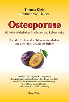 portada Osteoporose als Folge Fehlerhafter Ernährung und Lebensweise: Über die Irrtümer der Osteoporose-Medizin und die Kunst, Gesund zu Bleiben (en Alemán)