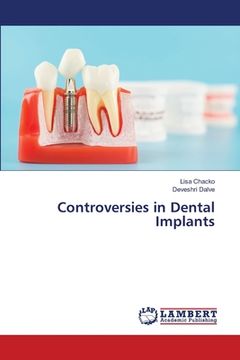 portada Controversies in Dental Implants (in English)