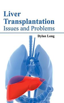 portada Liver Transplantation: Issues and Problems (in English)