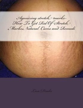 portada Agonizing stretch marks-How To Get Rid Of Stretch Marks: Natural Cures and Remedi