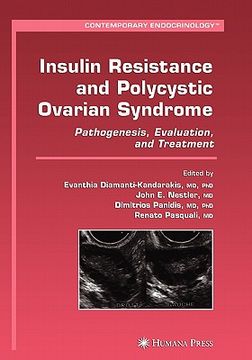 portada insulin resistance and polycystic ovarian syndrome: pathogenesis, evaluation, and treatment