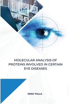 portada Molecular analysis of proteins involved in certain eye diseases (en Inglés)