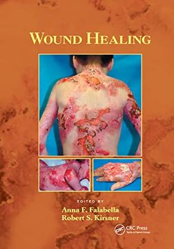 portada Wound Healing (Basic and Clinical Dermatology) (en Inglés)