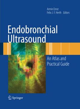 portada Endobronchial Ultrasound: An Atlas and Practical Guide (en Inglés)