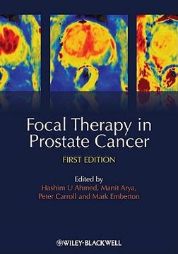 portada focal therapy in prostate cancer