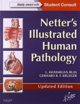 portada Netter's Illustrated Human Pathology Updated Edition: with Student Consult Access, 1e