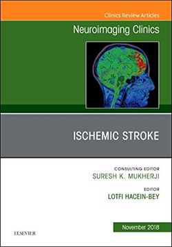 portada Ischemic Stroke, an Issue of Neuroimaging Clinics of North America, 1e (The Clinics: Radiology) (en Inglés)