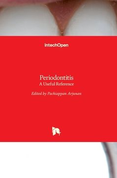 portada Periodontitis: A Useful Reference