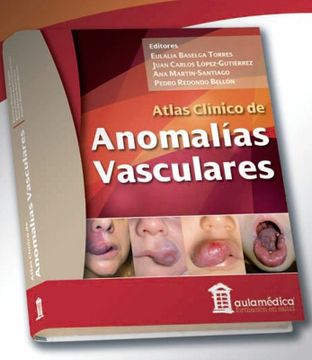 portada Atlas Clínico de Anomalías Vasculares (in Spanish)