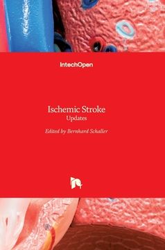 portada Ischemic Stroke: Updates