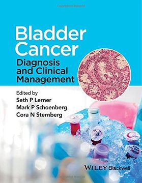 portada Bladder Cancer: Diagnosis and Clinical Management