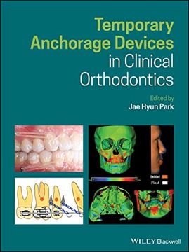 portada Temporary Anchorage Devices in Clinical Orthodontics (in English)