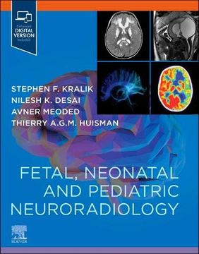 portada Fetal, Neonatal and Pediatric Neuroradiology (in English)