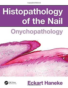 portada Histopathology of the Nail: Onychopathology (in English)