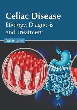 portada Celiac Disease: Etiology, Diagnosis and Treatment (en Inglés)
