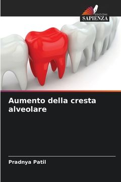 portada Aumento della cresta alveolare (en Italiano)