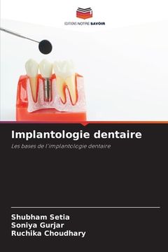 portada Implantologie dentaire (en Francés)