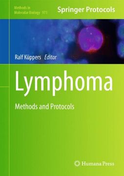 portada Lymphoma: Methods and Protocols (Methods in Molecular Biology)