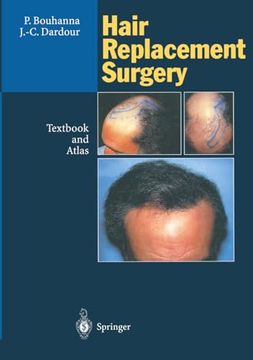 portada Hair Replacement Surgery: Textbook and Atlas (en Inglés)