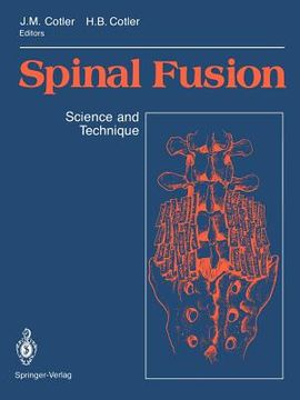 portada spinal fusion: science and technique (en Inglés)