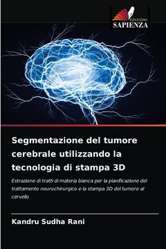 portada Segmentazione del tumore cerebrale utilizzando la tecnologia di stampa 3D (en Italiano)