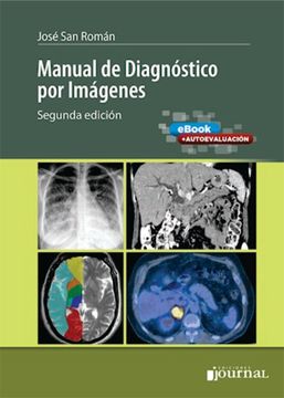 portada Manual de Diagnóstico por Imágenes (in Spanish)