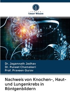 portada Nachweis von Knochen-, Haut- und Lungenkrebs in Röntgenbildern (in German)