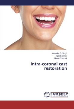 portada Intra-coronal cast restoration