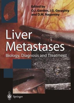 portada Liver Metastases: Biology, Diagnosis and Treatment (in English)