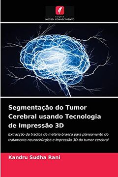 portada Segmentação do Tumor Cerebral Usando Tecnologia de Impressão 3d: Extracção de Tractos de Matéria Branca Para Planeamento do Tratamento Neurocirúrgico e Impressão 3d do Tumor Cerebral (en Portugués)