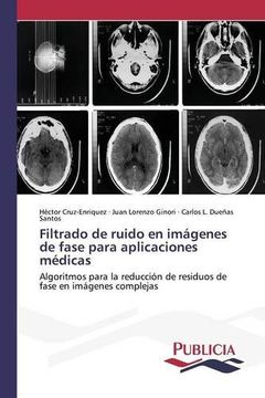 portada Filtrado de ruido en imágenes de fase para aplicaciones médicas