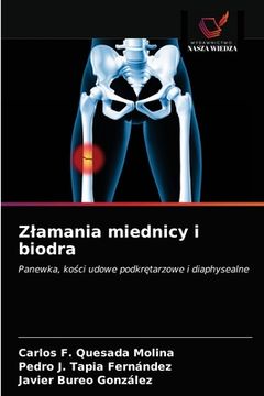 portada Zlamania miednicy i biodra (in Polaco)