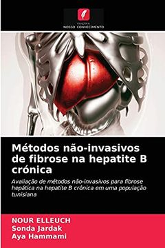 portada Métodos Não-Invasivos de Fibrose na Hepatite b Crónica: Avaliação de Métodos Não-Invasivos Para Fibrosehepática na Hepatite b Crônica em uma População Tunisiana (in Portuguese)