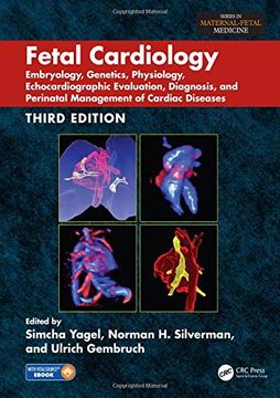 portada Fetal Cardiology: Embryology, Genetics, Physiology, Echocardiographic Evaluation, Diagnosis, and Perinatal Management of Cardiac Disease [With eBook] (in English)
