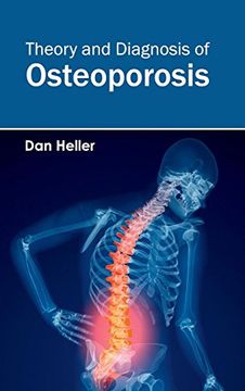 portada Theory and Diagnosis of Osteoporosis (en Inglés)
