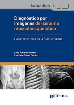 portada Diagnóstico por imágenes del sistema musculoesquelético. Casos de interés en la práctica diaria (in Spanish)