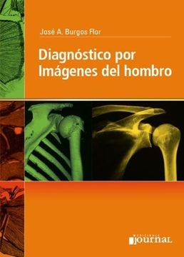 portada Diagnostico por Imagenes del Hombro (in Spanish)