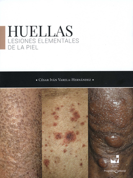 portada ATLAS DE DERMATOLOGIA CLINICA PIELES OSCURAS (in Spanish)