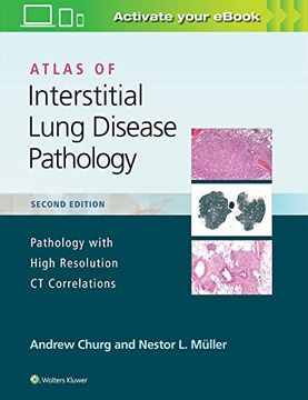 portada Atlas of Interstitial Lung Disease Pathology (en Inglés)