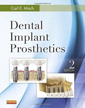 portada Dental Implant Prosthetics, 2e